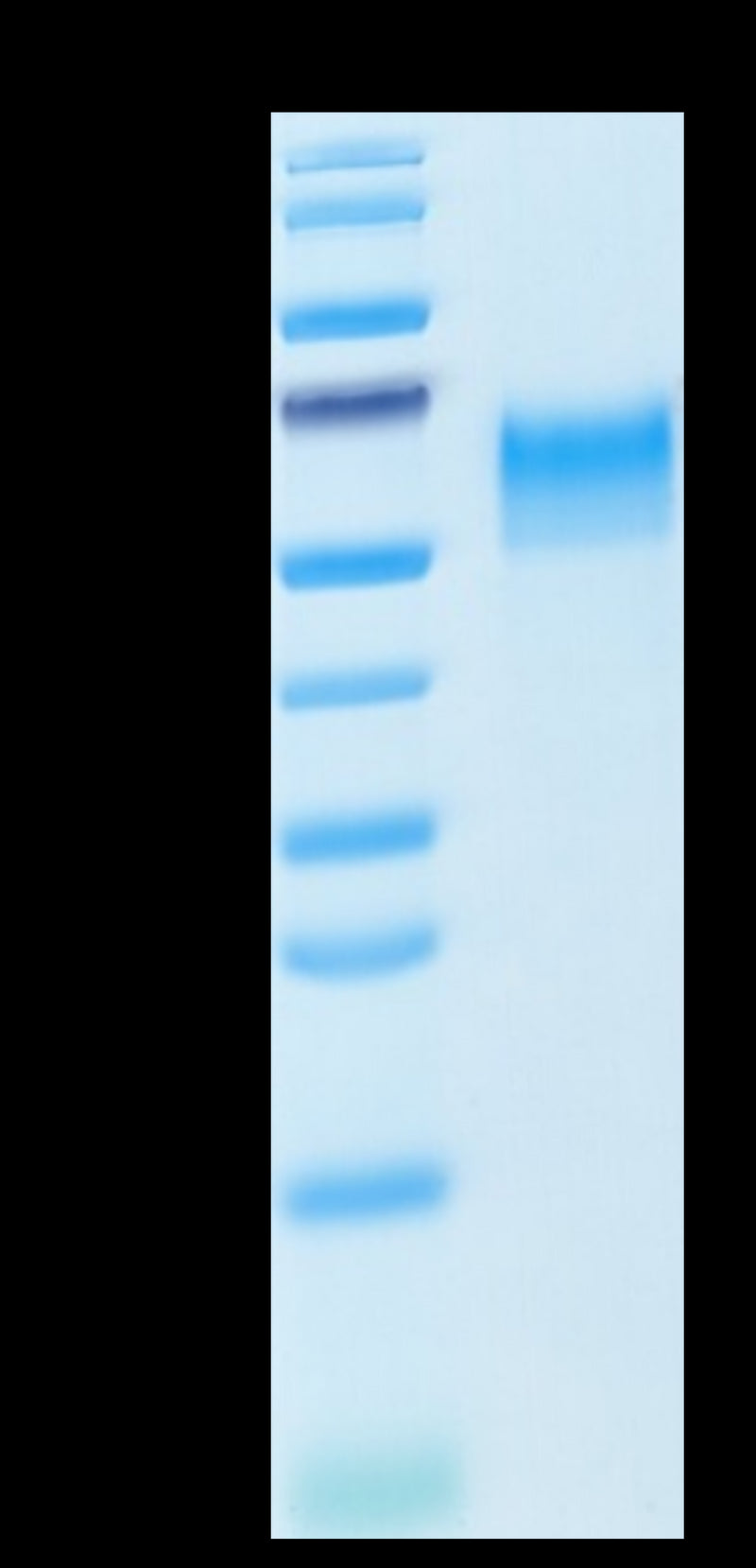 Mouse CD4 on Tris-Bis PAGE under reduced condition. The purity is greater than 95%.