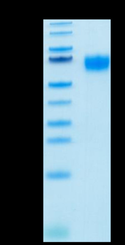 Biotinylated Human IL-2 R gamma on Tris-Bis PAGE under reduced condition. The purity is greater than 95%.