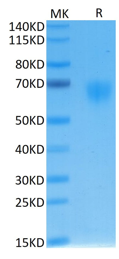 Human IL-2 R gamma on Tris-Bis PAGE under reduced condition. The purity is greater than 95%.