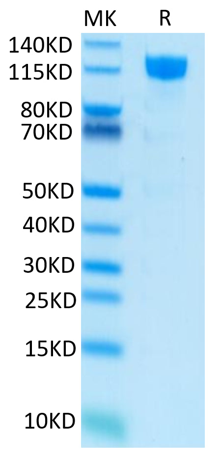 Human M-CSF R on Tris-Bis PAGE under reduced condition. The purity is greater than 95%.