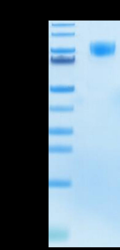 Human M-CSF R Tris-Bis PAGE under reduced condition. The purity is greater than 95%.