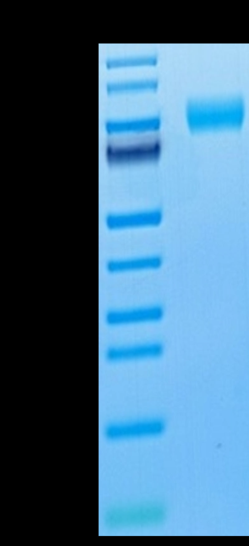 Cynomolgus M-CSF R on Tris-Bis PAGE under reduced condition. The purity is greater than 95%.