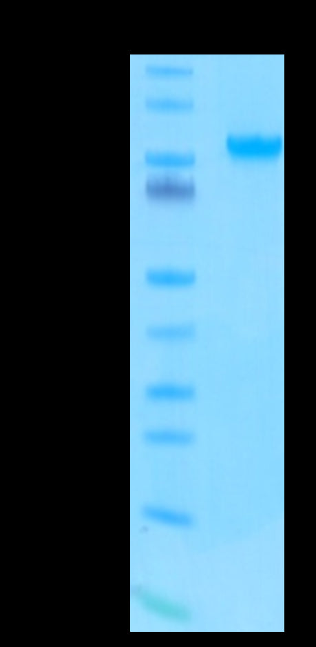 Human/Cynomolgus/Rhesus macaque ROR1 on Tris-Bis PAGE under reduced condition. The purity is greater than 95%.