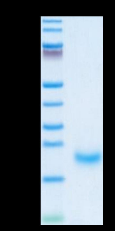 Human/Cynomolgus/Rhesus macaque ROR1 (308-395, Kringle Domain) on Tris-Bis PAGE under reduced condition. The purity is greater than 95%.