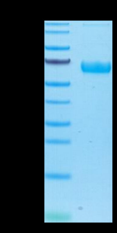 Human/Cynomolgus/Rhesus macaque ROR1 on Tris-Bis PAGE under reduced condition. The purity is greater than 95%.