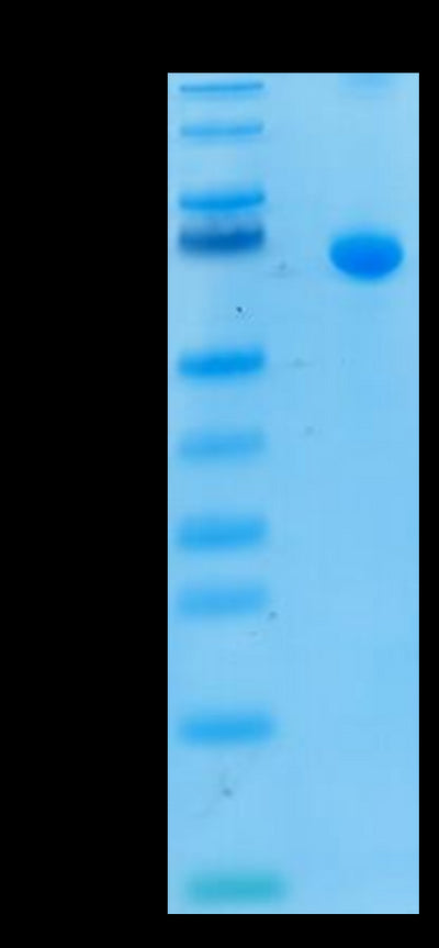 Human IL-13Ra2 on Tris-Bis PAGE under reduced condition. The purity is greater than 95%.