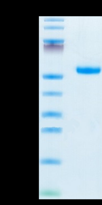 Mouse IL-5 R alpha on Tris-Bis PAGE under reduced condition. The purity is greater than 95%.