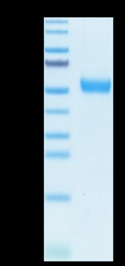 Human IL-5R alpha on Tris-Bis PAGE under reduced condition. The purity is greater than 95%.