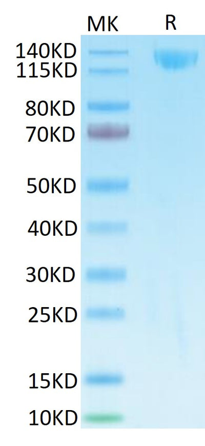 SARS Spike S1 on Tris-Bis PAGE under reduced condition. The purity is greater than 95%.