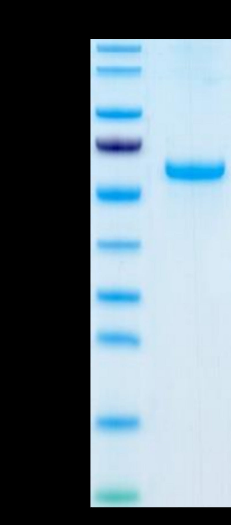 Human Adiponectin on Tris-Bis PAGE under reduced condition. The purity is greater than 95%.