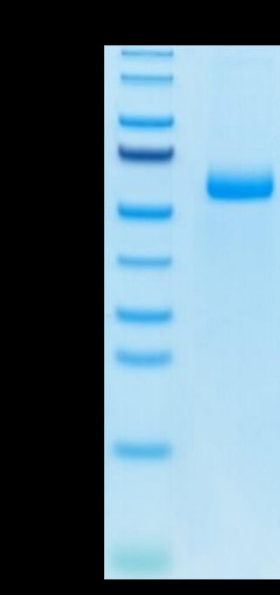 Mouse Adiponectin on Tris-Bis PAGE under reduced condition. The purity is greater than 95%.