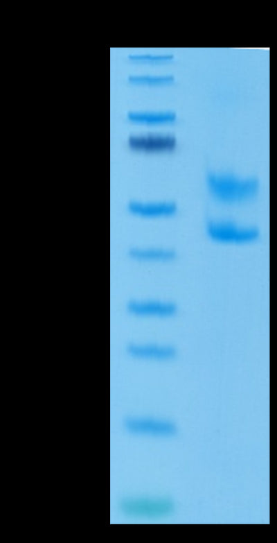 Mouse CD3E&CD3D on Tris-Bis PAGE under reduced condition. The purity is greater than 95%.