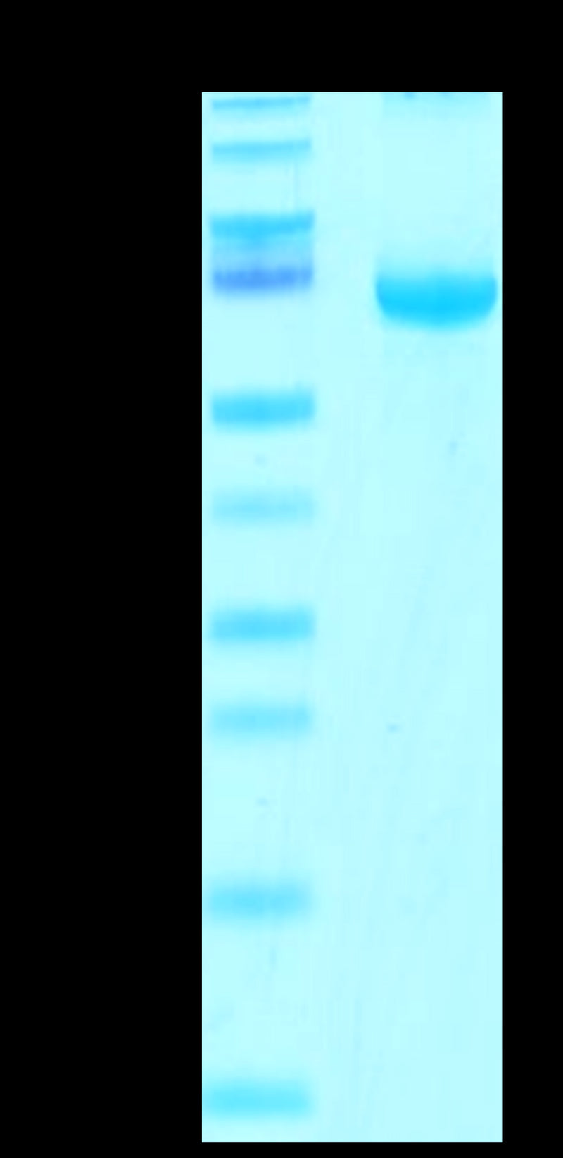 Cynomolgus FGL1 on Tris-Bis PAGE under reduced condition. The purity is greater than 95%.