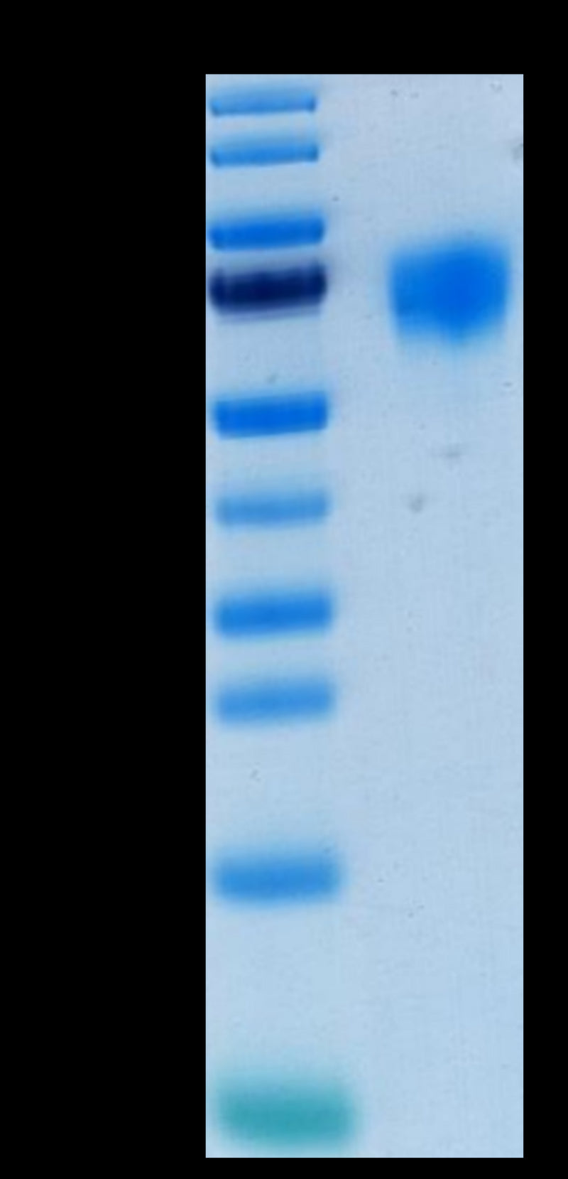 Human FGFR4 on Tris-Bis PAGE under reduced condition. The purity is greater than 95%.