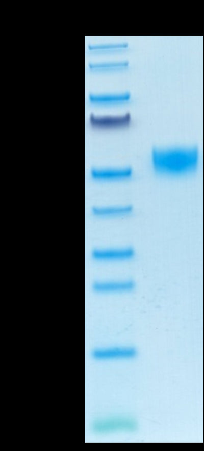 Mouse CD5 on Tris-Bis PAGE under reduced condition. The purity is greater than 95%.