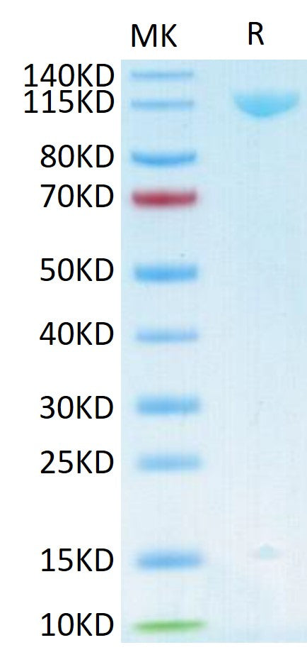 Human Her3 on Tris-Bis PAGE under reduced conditions. The purity is greater than 95%.