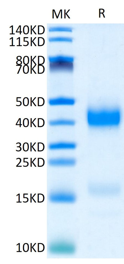 Human Azurocidin on Tris-Bis PAGE under reduced condition. The purity is greater than 95%.