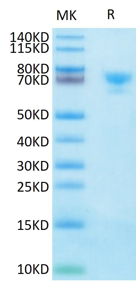 Biotinylated Human MSLN on Tris-Bis PAGE under reduced condition. The purity is greater than 95%.