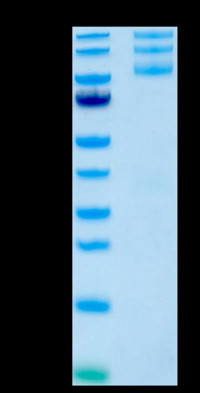 Human ITGAV&ITGB5-on Tris-Bis PAGE under reduced conditions. The purity is greater than 95%.