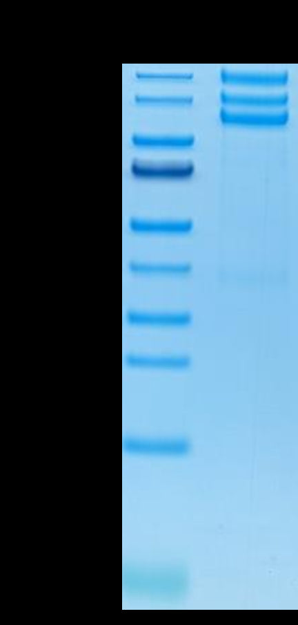 Human ITGAV&ITGB3 on Tris-Bis PAGE under reduced conditions. The purity is greater than 95%.