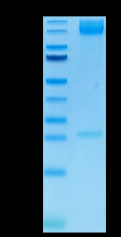 Human ITGA5&ITGB1 on Tris-Bis PAGE under reduced condition. The purity is greater than 95%.