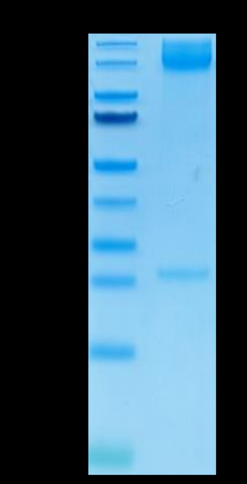 Human ITGA5&ITGB1 on Tris-Bis PAGE under reduced condition. The purity is greater than 95%.