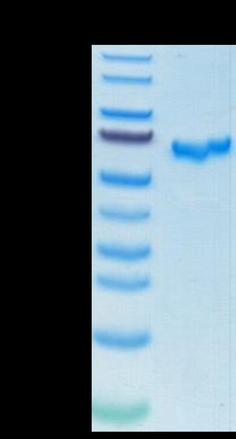 SARS-COV-2 Spike RBD on Tris-Bis PAGE under reduced condition. The purity is greater than 95%.