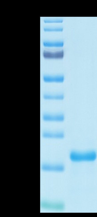 SARS-COV-2 NP NTD Domain on Tris-Bis PAGE under reduced condition. The purity is greater than 95%.