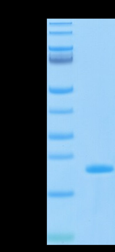 Biotinylated SARS-COV-2 Nucleocapsid CTD Domain on Tris-Bis PAGE under reduced condition. The purity is greater than 95%.