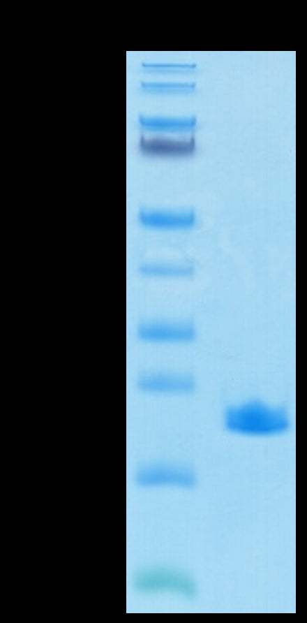 SARS-COV-2 NP CTD Domain on Tris-Bis PAGE under reduced condition. The purity is greater than 95%.