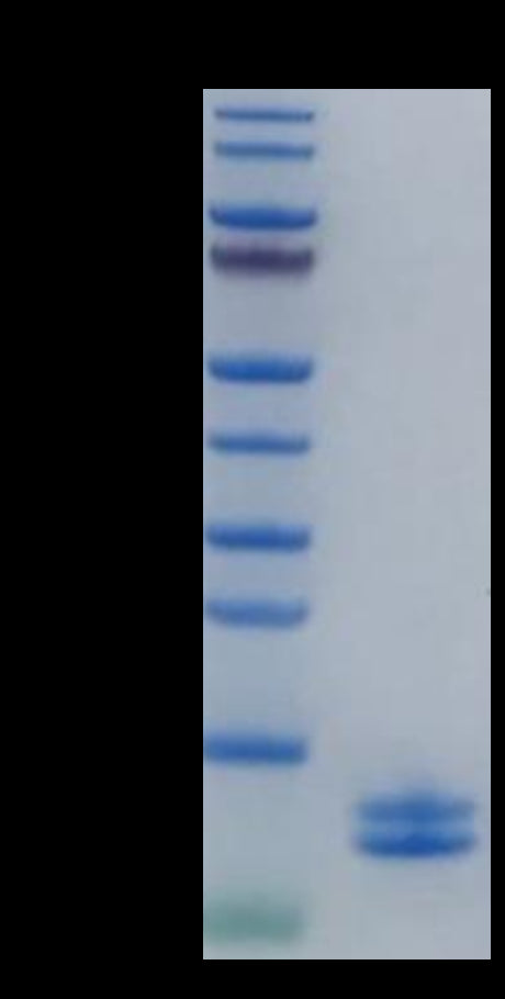 Human Calprotectin (S100A8&S100A9) on Tris-Bis PAGE under reduced condition. The purity is greater than 95%.