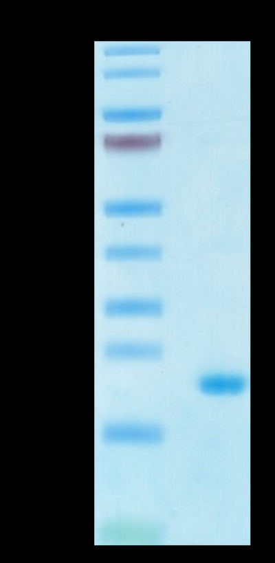 Human IL-10 on Tris-Bis PAGE under reduced condition. The purity is greater than 95%.