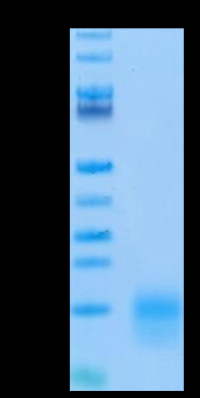 Biotinylated Mouse BCMA on Tris-Bis PAGE under reduced condition. The purity is greater than 95%.