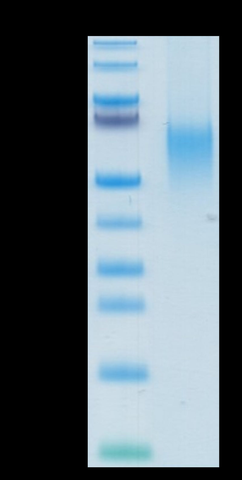 Human B7-1 on Tris-Bis PAGE under reduced condition. The purity is greater than 95%.