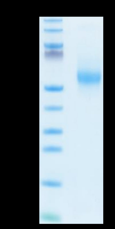 Human IL-3 on Tris-Bis PAGE under reduced condition. The purity is greater than 95%.