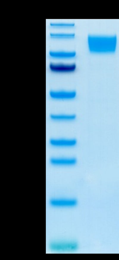 Human GUCY2C on Tris-Bis PAGE under reduced condition. The purity is greater than 95%.