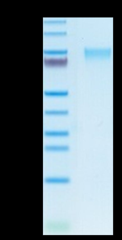 Human GUCY2C on Tris-Bis PAGE under reduced condition. The purity is greater than 95%.