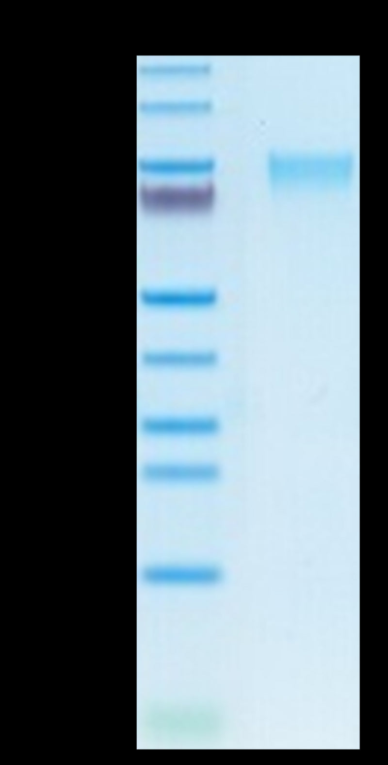 Human GUCY2C on Tris-Bis PAGE under reduced condition. The purity is greater than 95%.