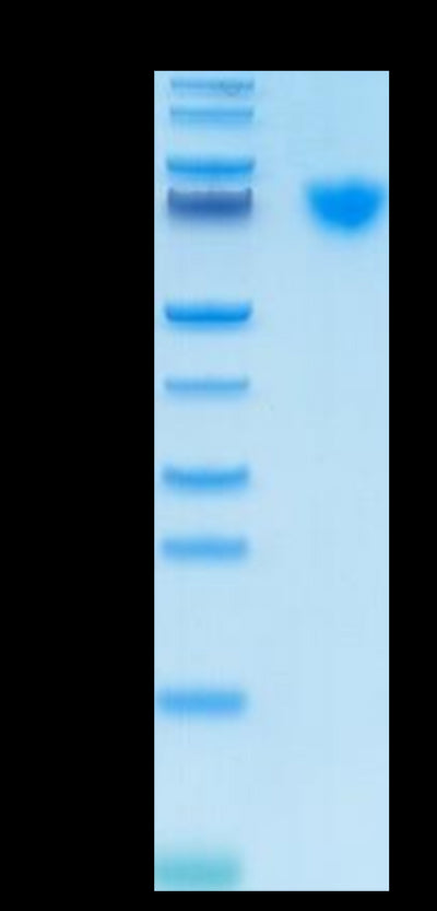 Cynomolgus GUCY2C on Tris-Bis PAGE under reduced condition. The purity is greater than 95%.