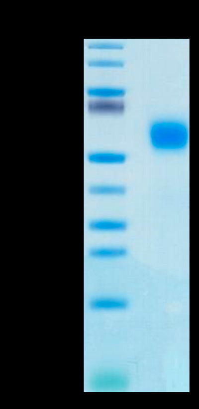 Human IL-1R2 on Tris-Bis PAGE under reduced condition. The purity is greater than 95%.