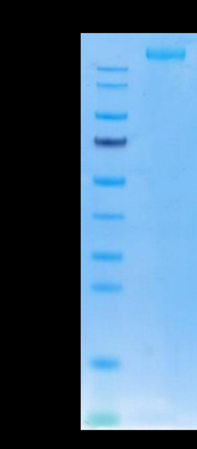 SARS-COV-2 Spike S (Trimer) on Tris-Bis PAGE under reduced condition. The purity is greater than 95%.