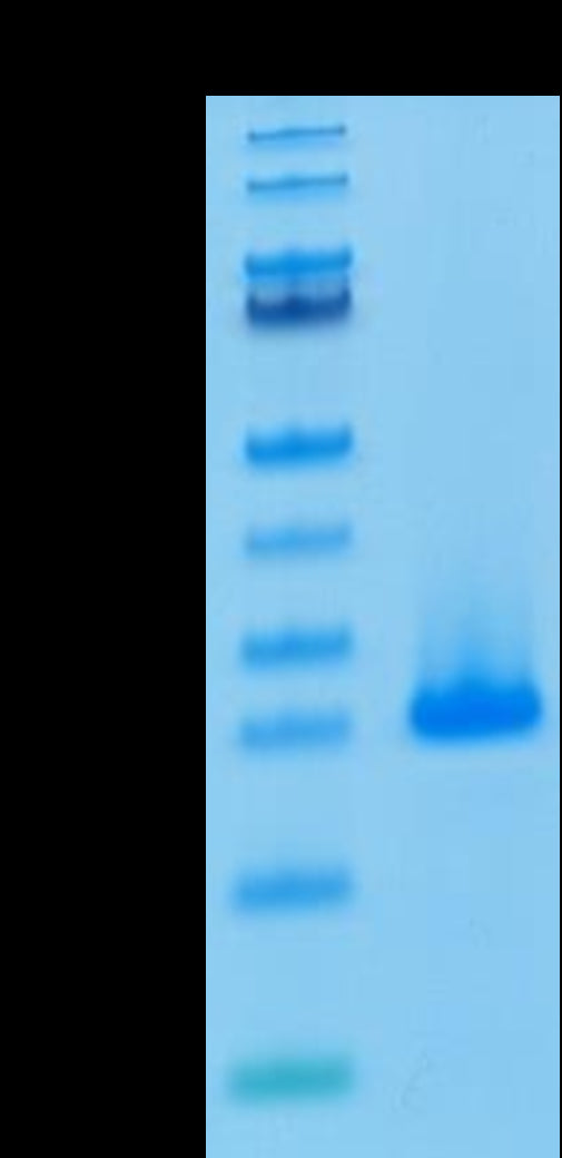 Human FGF10 on Tris-Bis PAGE under reduced condition. The purity is greater than 95%.