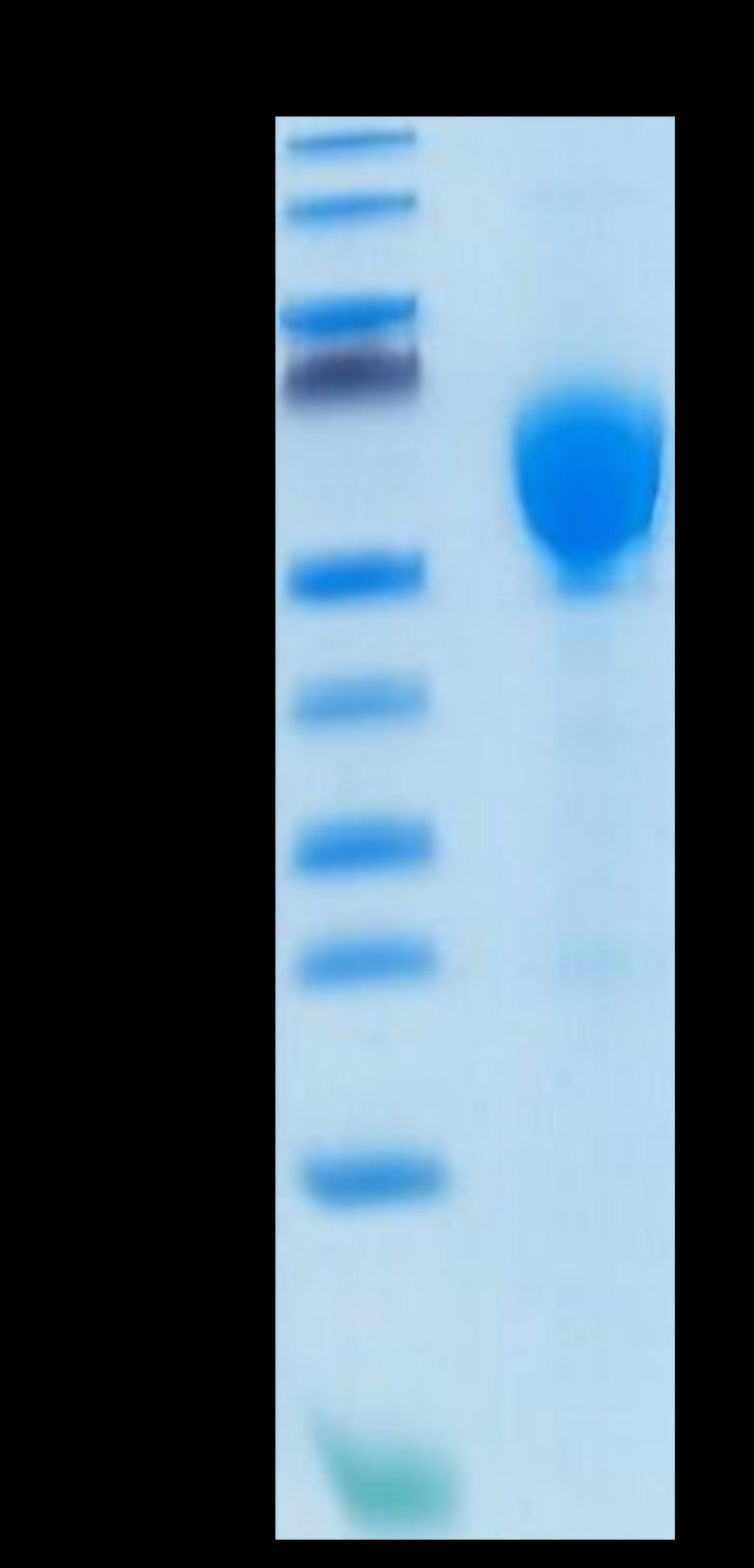 Human GITR Ligand Trimer on Tris-Bis PAGE under reduced condition. The purity is greater than 95%.