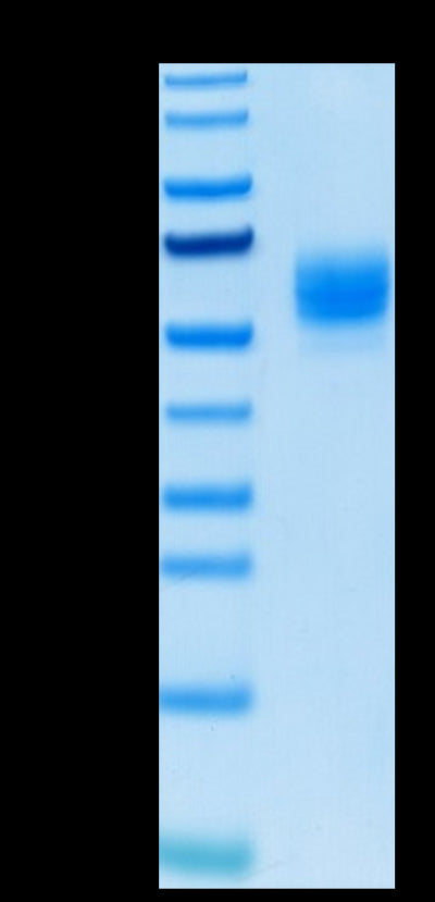 Biotinylated Human GITR Ligand Trimer on Tris-Bis PAGE under reduced condition. The purity is greater than 95%.