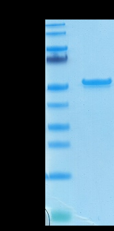 Biotinylated SARS-COV-2 Nucleocapsid on Tris-Bis PAGE under reduced condition. The purity is greater than 95%.