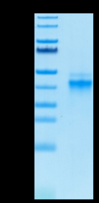 Biotinylated Human IL-12 on Tris-Bis PAGE under reduced condition. The purity is greater than 95%.