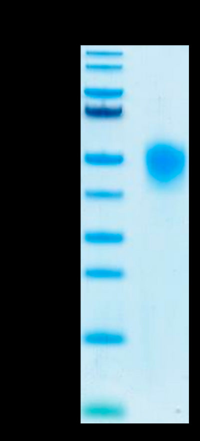 Human KIR2DL1 on Tris-Bis PAGE under reduced conditions. The purity is greater than 95%.