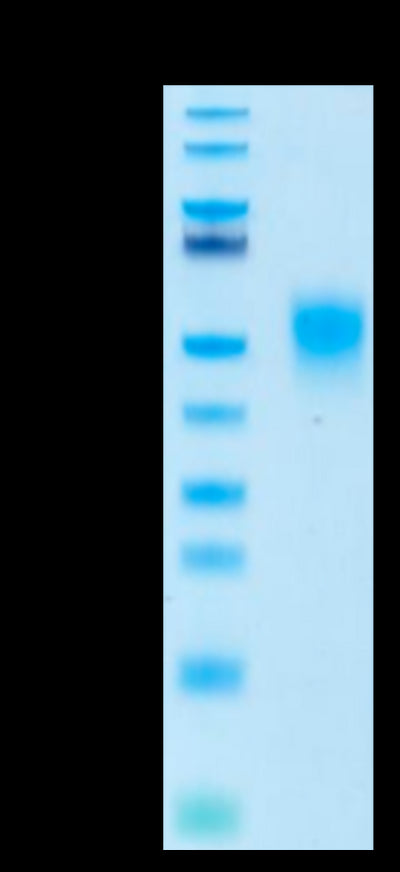 Biotinylated Human KIR2DL1 on Tris-Bis PAGE under reduced conditions. The purity is greater than 95%.