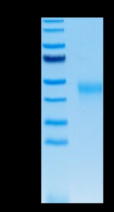 Human KIR2DL2 on Tris-Bis PAGE under reduced conditions. The purity is greater than 95%.