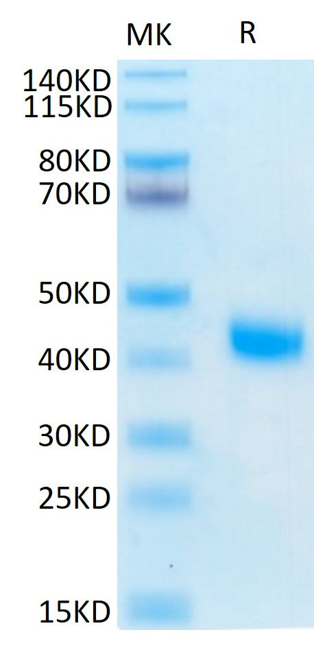 Human IL-2 R beta on Tris-Bis PAGE under reduced condition. The purity is greater than 95%.